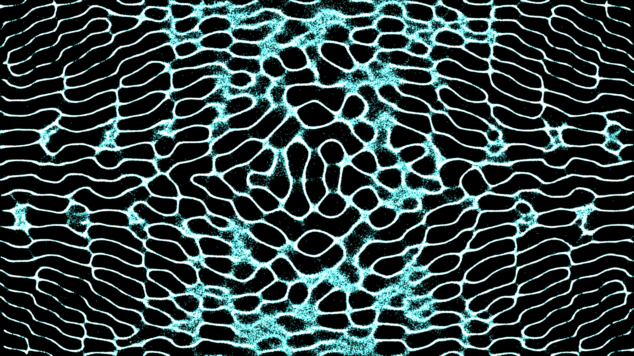 Multisig Treasury (Gnosis Safe)